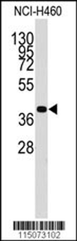 LECT1 Antibody (C-term)