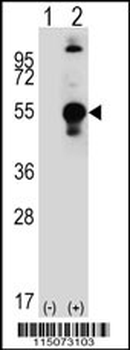 LECT1 Antibody (C-term)