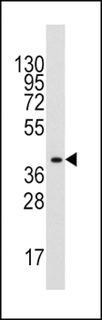 ALDOA Antibody (C-term)