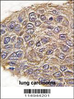 Aldolase (ALDOA) Antibody (N-term)
