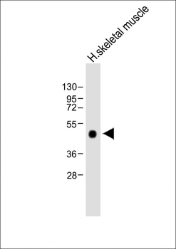 WIF1 Antibody(Human C-term)