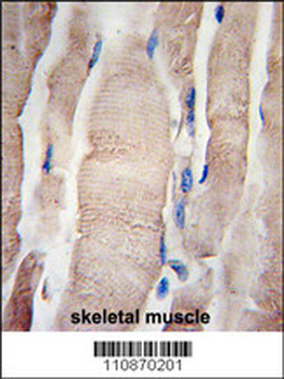 PHPT1 Antibody( C-term)