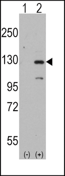 DAAM1 Antibody (N-term)