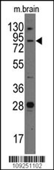 Junctophilin 3 Antibody (Center)