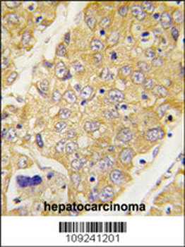 Dtnbp1 Antibody (C-term)