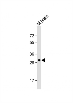 Dtnbp1 Antibody (C-term)