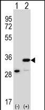 PHB Antibody (Center)