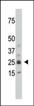 SULT1C1 Antibody (Center)