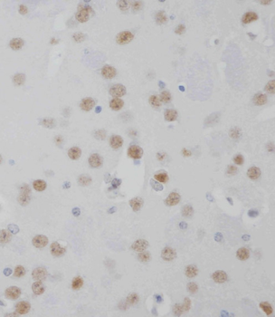 MeCP2 Antibody