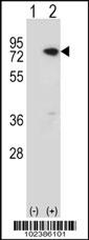 MeCP2 Antibody (C-term)