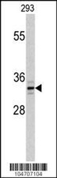 PPT1 Antibody (C-term)