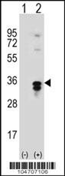 PPT1 Antibody (C-term)