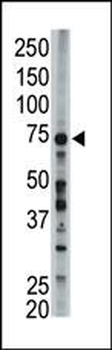 FACL6 Antibody (Center)