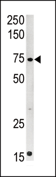 CPT2 Antibody (C-term)
