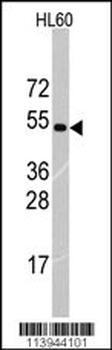 RNF36 (TRIM69) Antibody (Center K251)