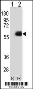 NMT2 Antibody (N-term)