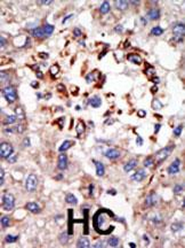 CBX8 Antibody (C-term)