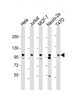 EZH2 Antibody
