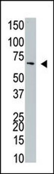 NYREN18 Antibody (C-term)