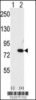 NYREN18 Antibody (C-term)