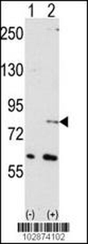 NYREN18 Antibody (N-term)