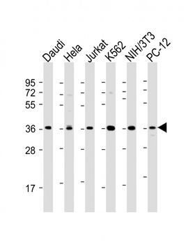 IKB alpha (IKBA) Antibody