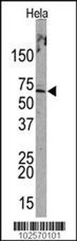 PML Sumoylation Site Antibody