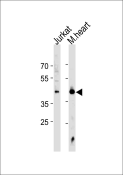 HSF1 Sumoylation Site Antibody