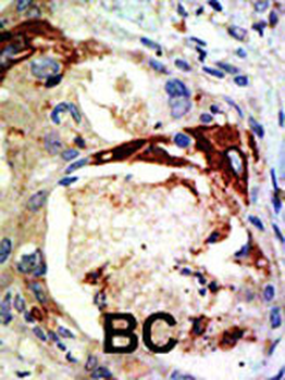 Myb Sumoylation Site Antibody