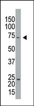 GPIP137 Antibody (C-term)