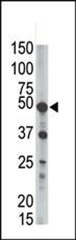 GPI8 Antibody (C-term)
