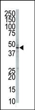 GPI8 Antibody (N-term)