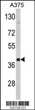 FNTA Antibody (C-term)