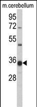 GGPS1 Antibody (C-term)