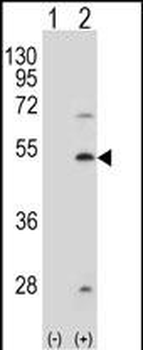 FDFT1 Antibody (Center)