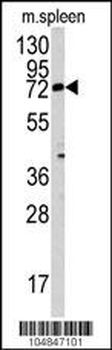 MGAT3 Antibody (N-term)