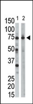 Ribophorin (RPN1) Antibody (C-term)