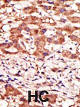 MGAT1 Antibody (N-term)