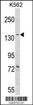 AGL Antibody (Center)
