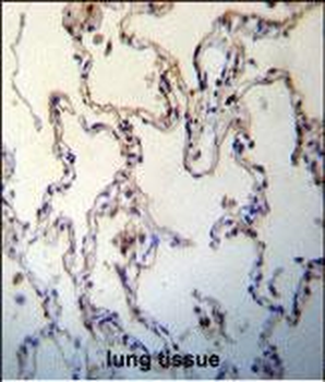 RAGE (AGER) Antibody (C-term)