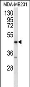 RAGE (AGER) Antibody (C-term)