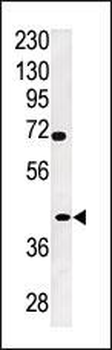 TPST2 Antibody (C-term)