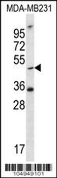 TPST1 Antibody (C-term)