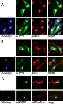GGA1 Antibody (N-term)