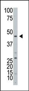 ART3 Antibody (C-term)