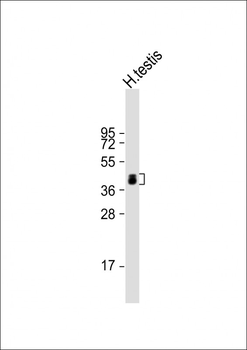 ART3 Antibody (C-term)