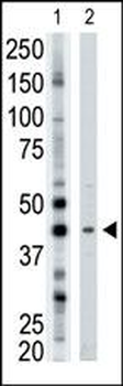 ART3 Antibody (N-term)