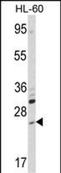 ARL6 Antibody (N-term)