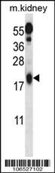 Ufc1 Antibody (C-term)