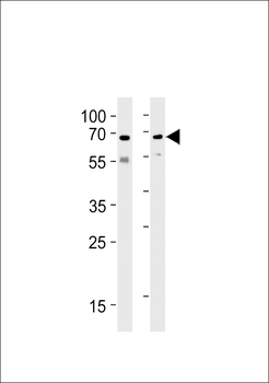 Ubiquilin1 (PLIC1) Antibody (N-term)